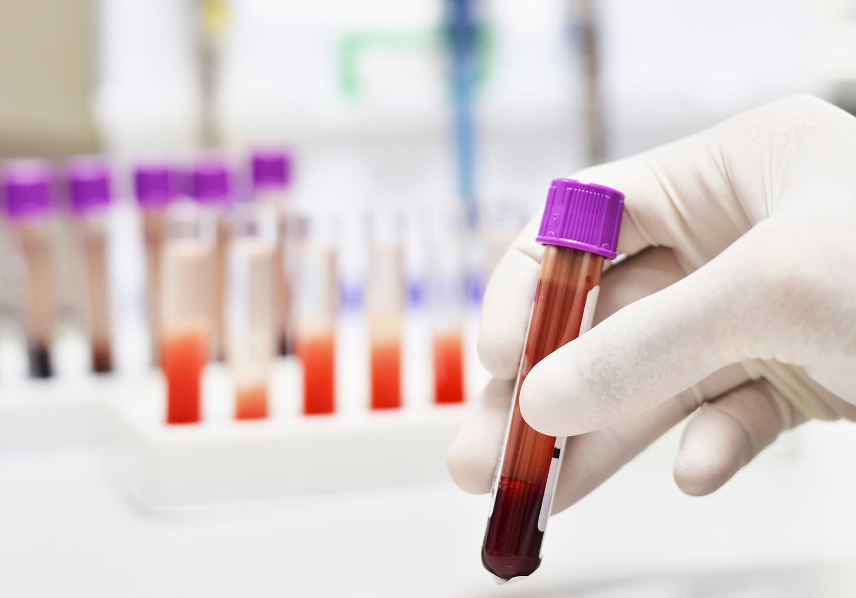 Trepanobiopsja Opatrunek Uciskowy Jak Długo