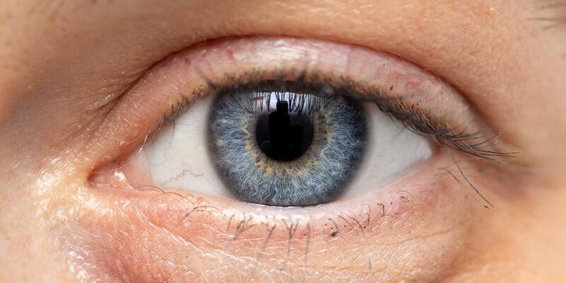 kurza ślepota - zdjęcie obrazujące oko z bliska