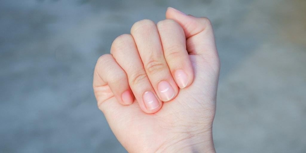 miękkie i łamliwe paznokcie