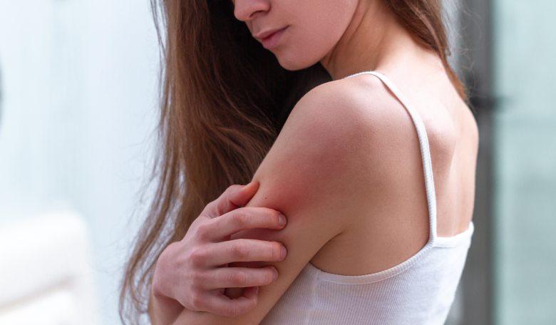 alergia kontaktowa