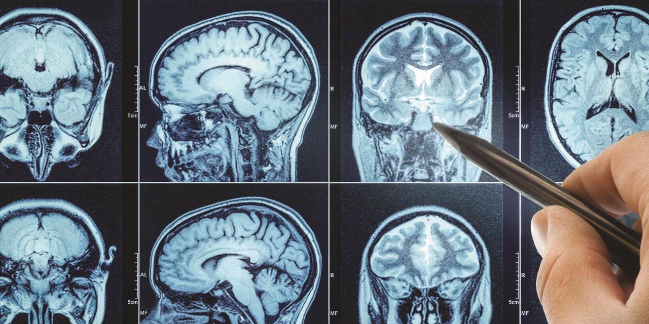 Neuroprzekaźniki