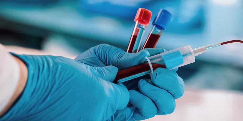 hipertriglicerydemia
