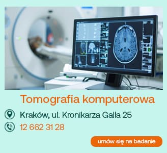 tomografia komputerowa Kraków, ul. Kronikarza Galla 25 12 662 31 28 umów się na badanie