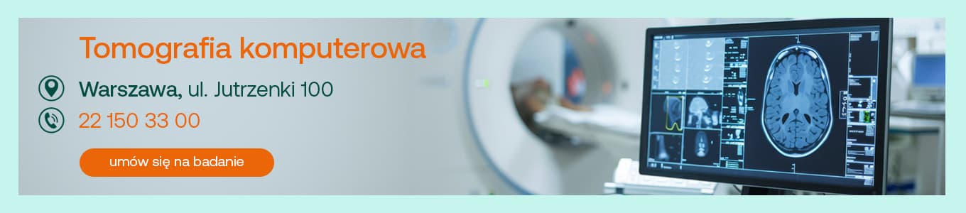 tomografia komputerowa Warszawa, ul. Jutrzenki 100 22 150 33 00 umów się na badanie