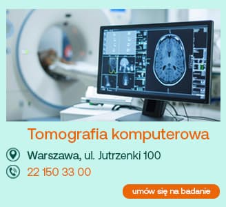 tomografia komputerowa Warszawa, ul. Jutrzenki 100 22 150 33 00 umów się na badanie