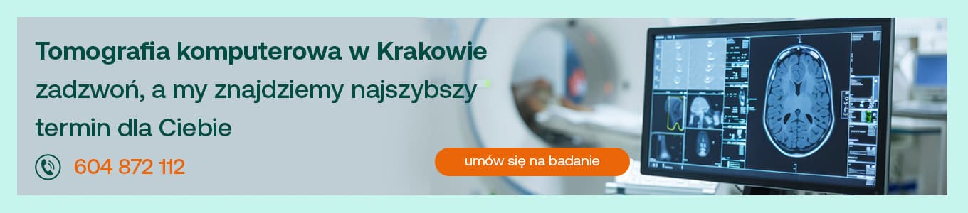 tomografia komputerowa w krakowie zadzwoń a my znajdzemy najszybszy termin dla Ciebie 604 872 112 umów się na badanie