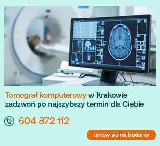 tomografia komputerowa w krakowie zadzwoń a my znajdzemy najszybszy termin dla Ciebie 604 872 112 umów się na badanie