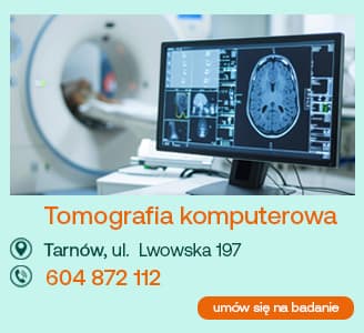 tomografia komputerowa tarnów ul. lwowska 197 604 872 112 umów się na badanie