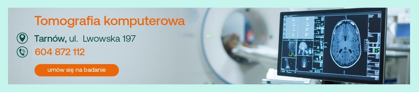 tomografia komputerowa tarnów ul. lwowska 197 604 872 112 umów się na badanie