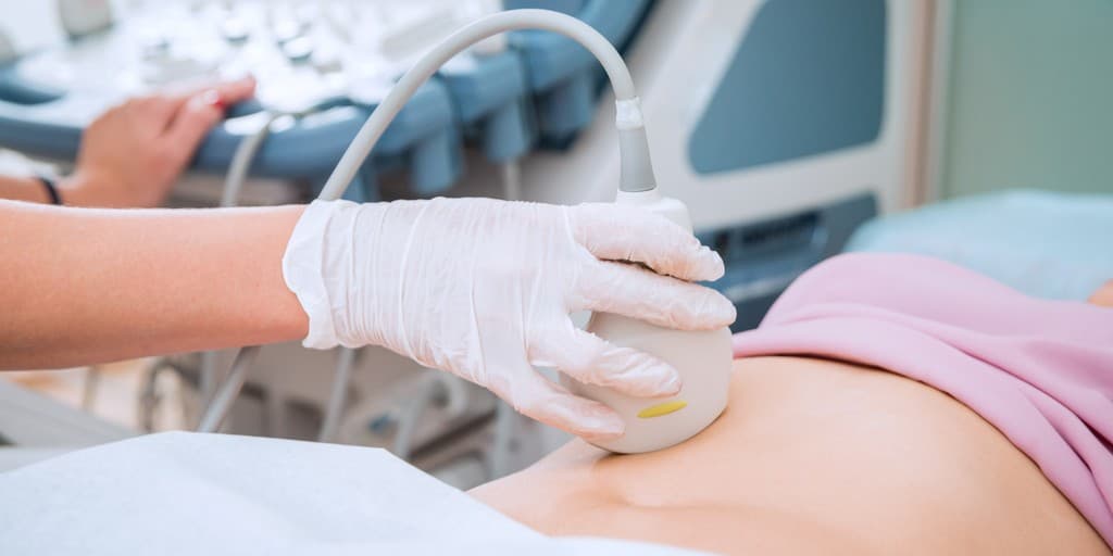 pęcherzyk ciążowy