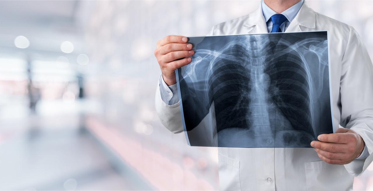 spirometria i rentgen płuc