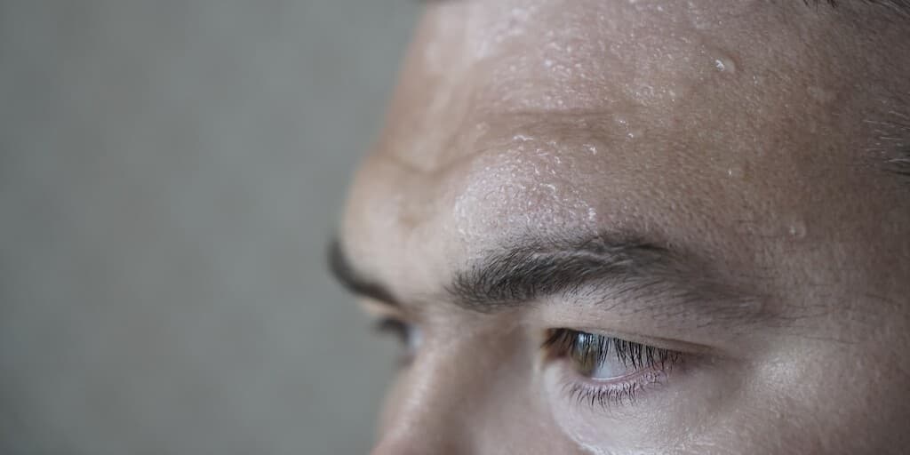 Nadmierne pocenie się głowy i twarzy