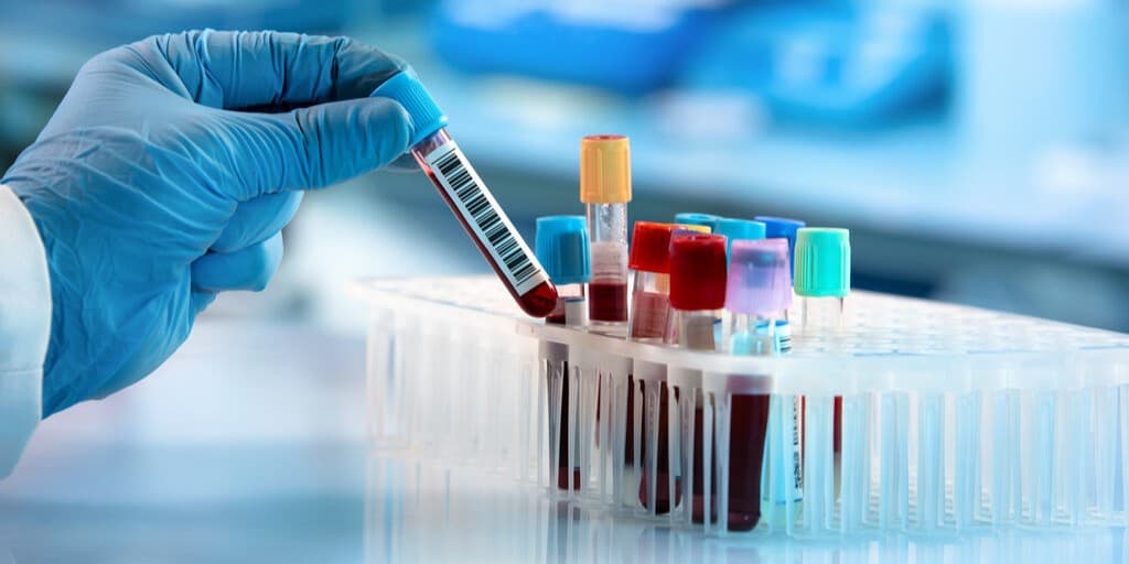 Rak jelita grubego i markery nowotworowe