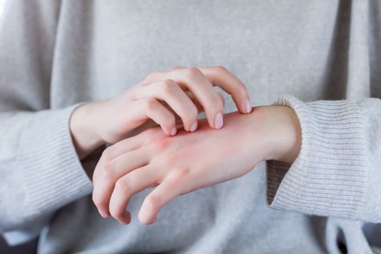 choroby autoimmunologiczne i dermatologiczne