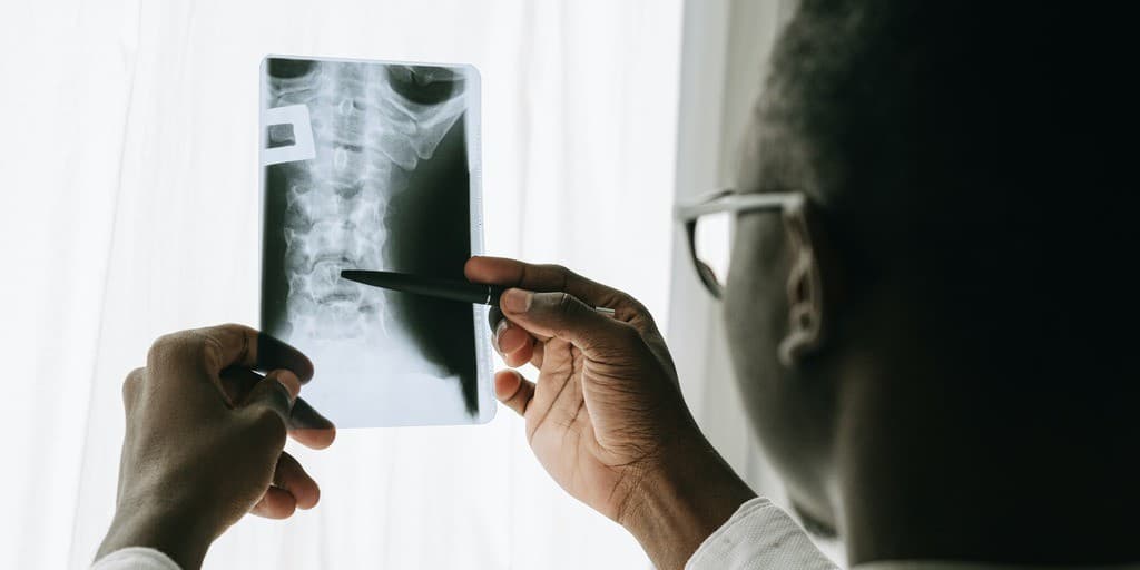 Syringomyelia
