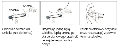 instrukcja_pobierania_wymazu_okoloodbytniczego